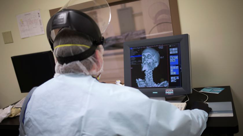 Luz verde a curso de Medicina na Católica é ceder a "forte pressão" política, acusa Conselho de Escolas Médicas